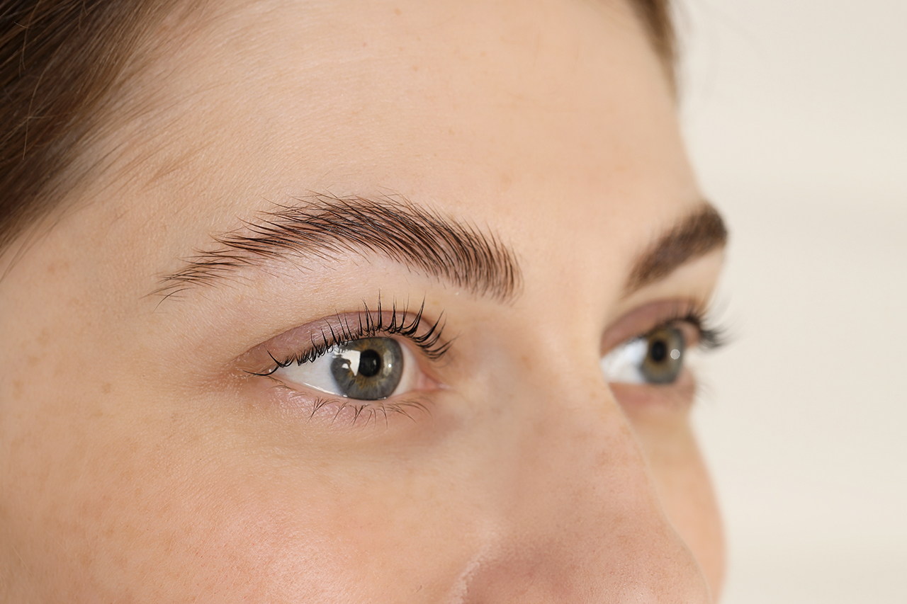 Endoscopic Brow Lift – Austin Forehead Lift Incisions