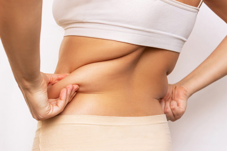 Excess Skin After Weight Loss | Austin, Texas