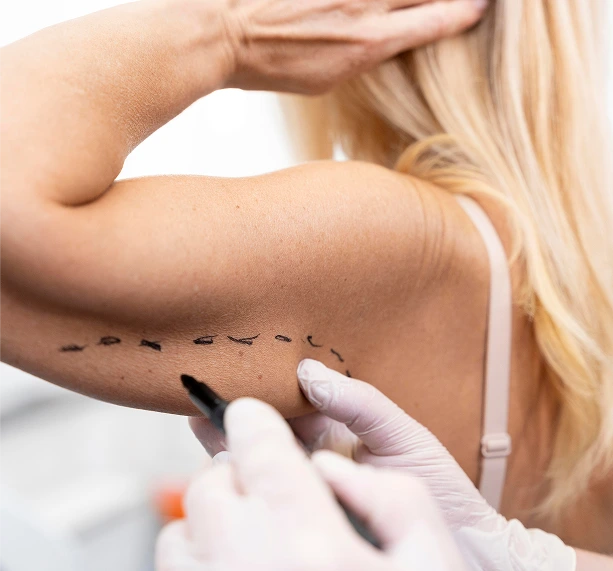 Austin, TX Body Surgery: Arm Lift (Brachioplasty) Banner