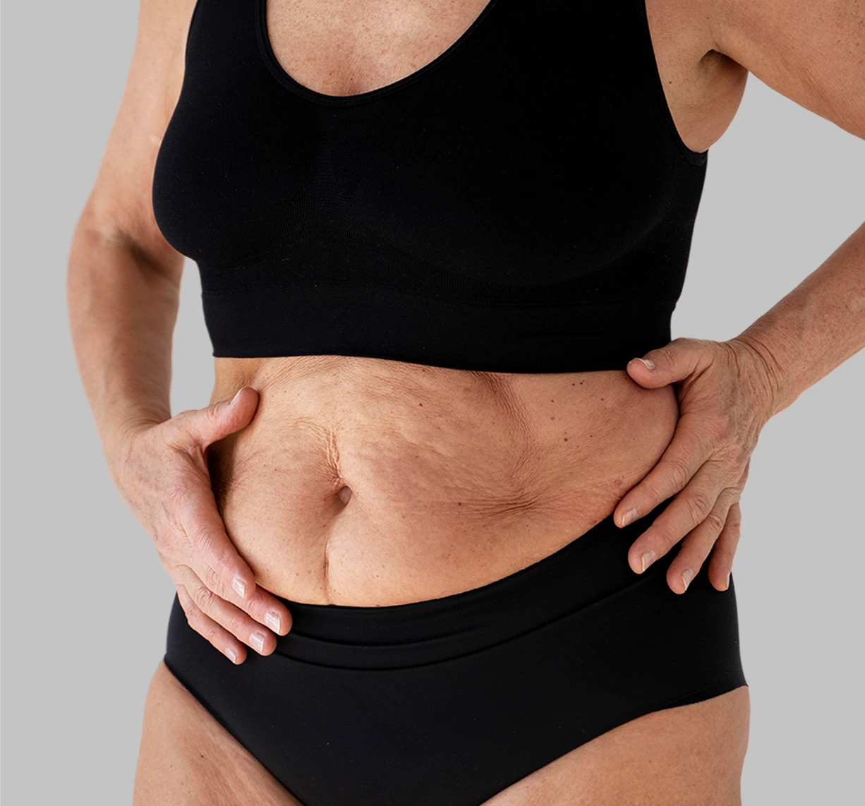 Surgery Body in Austin TX: Fleur-De-Lis Tummy Tuck Banner