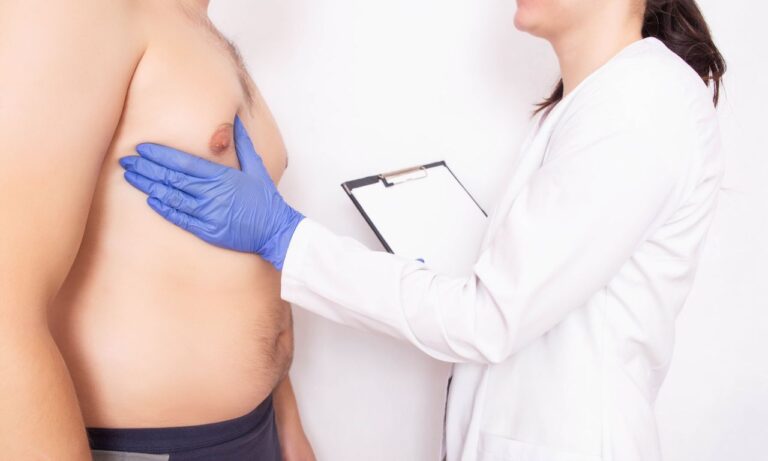 What Causes Gynecomastia? Banner