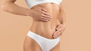 Difference Between Tummy Tuck And Liposuction Banner