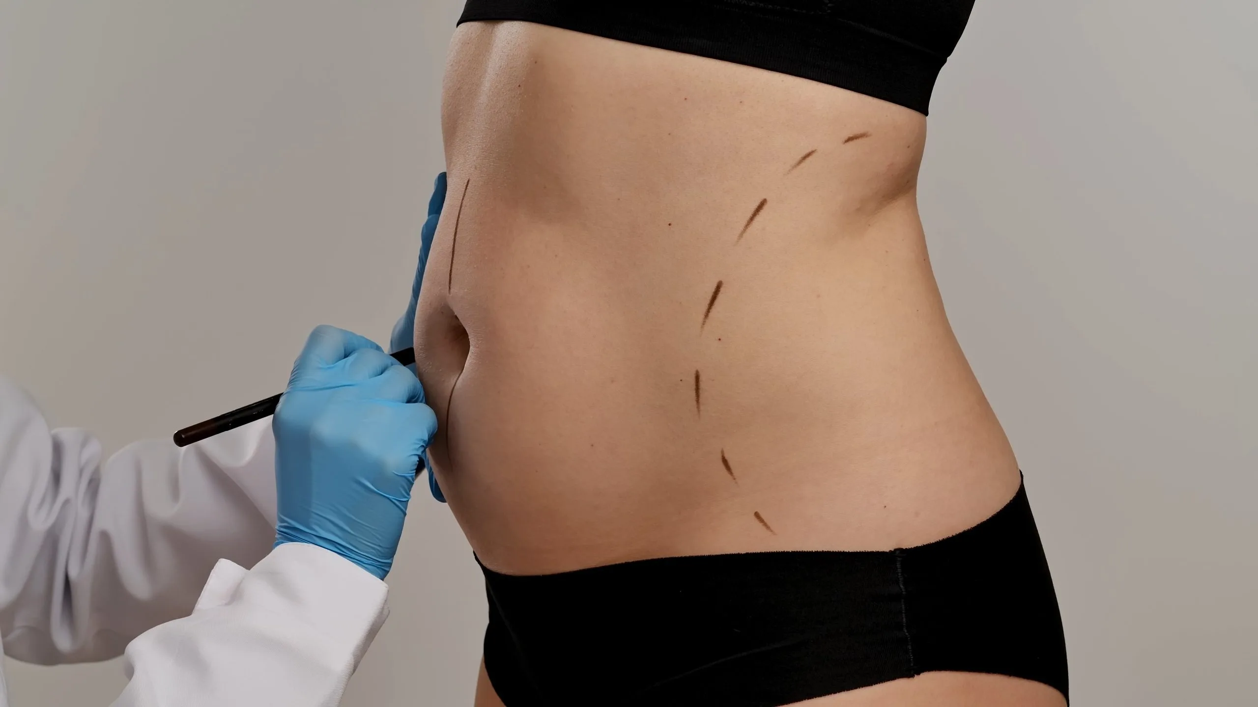 Are You Awake During Liposuction? Banner
